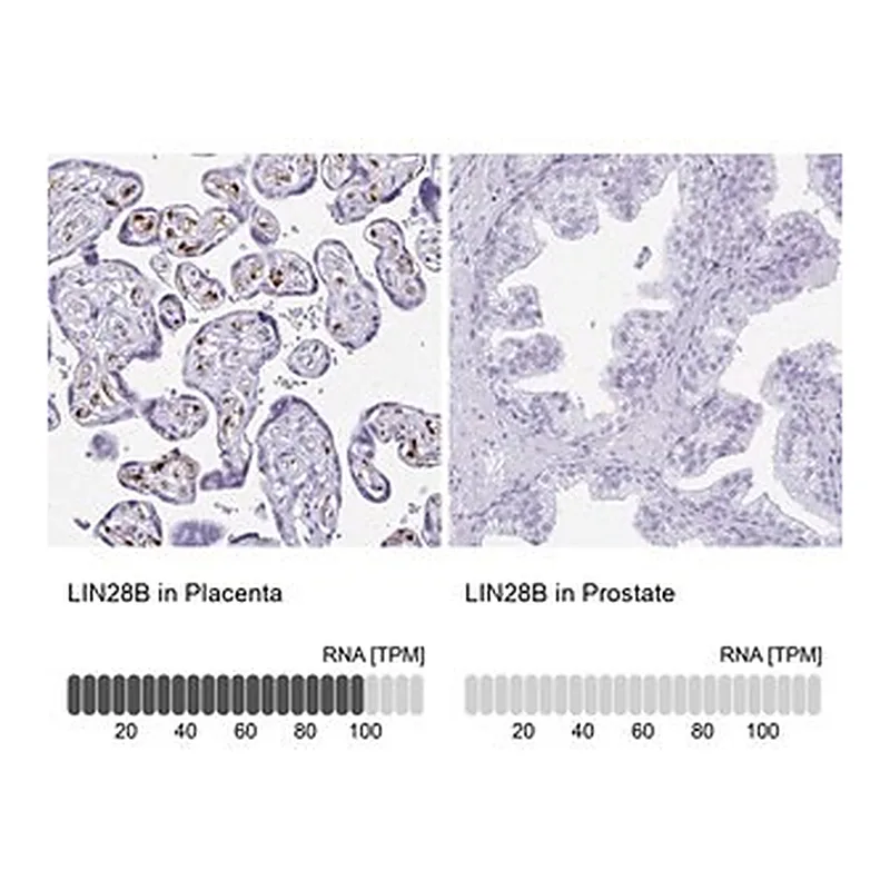 Merck Anti-LIN28B antibody produced in rabbit