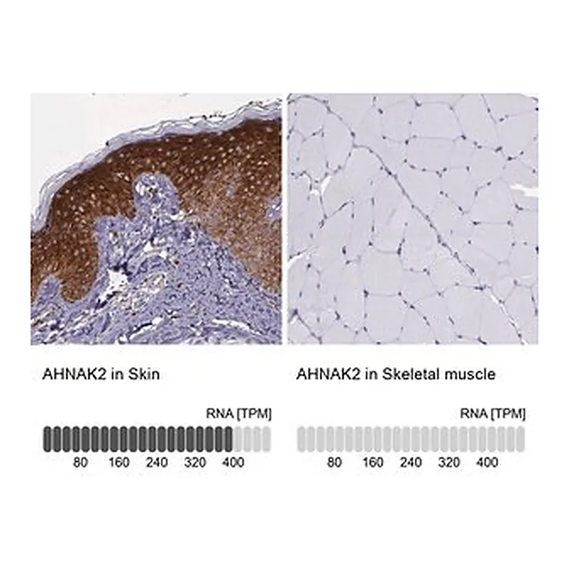 Merck Anti-AHNAK2 antibody produced in rabbit