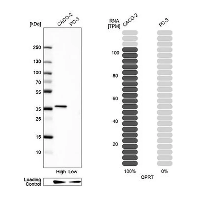 Merck Anti-QPRT antibody produced in rabbit