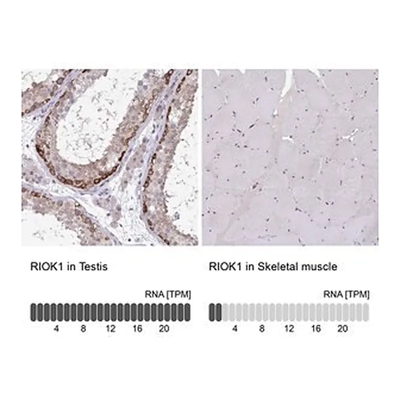 Merck Anti-RIOK1 antibody produced in rabbit