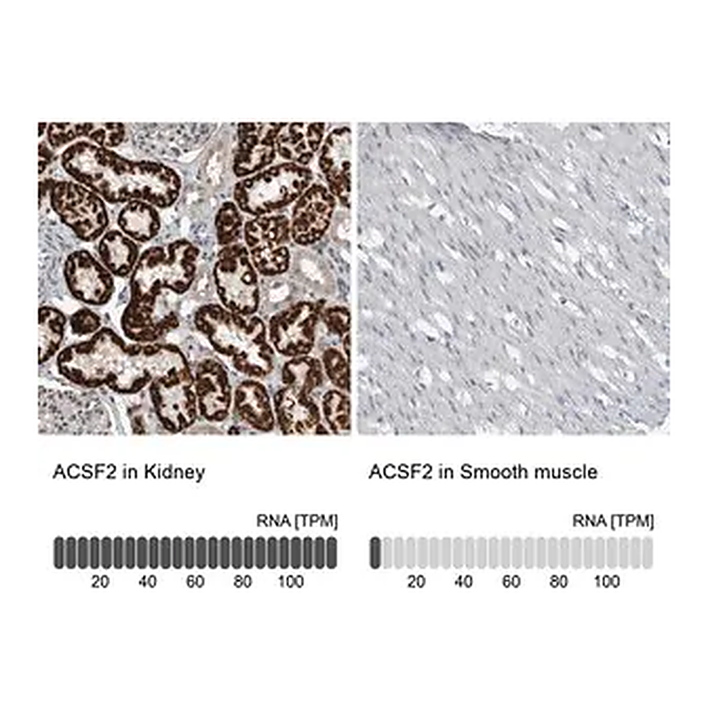 Merck Anti-ACSF2 antibody produced in rabbit