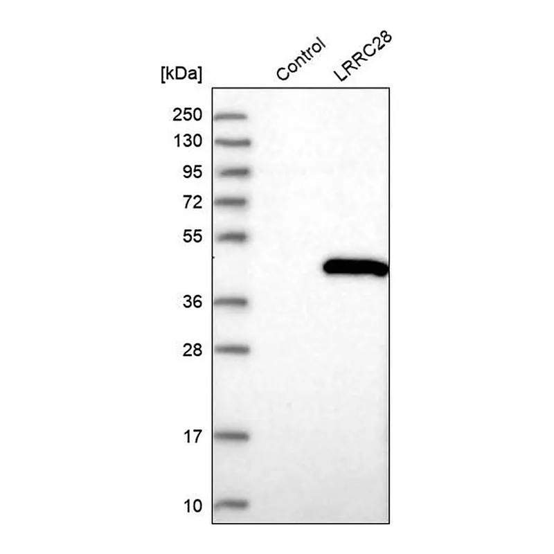 Merck Anti-LRRC28 antibody produced in rabbit