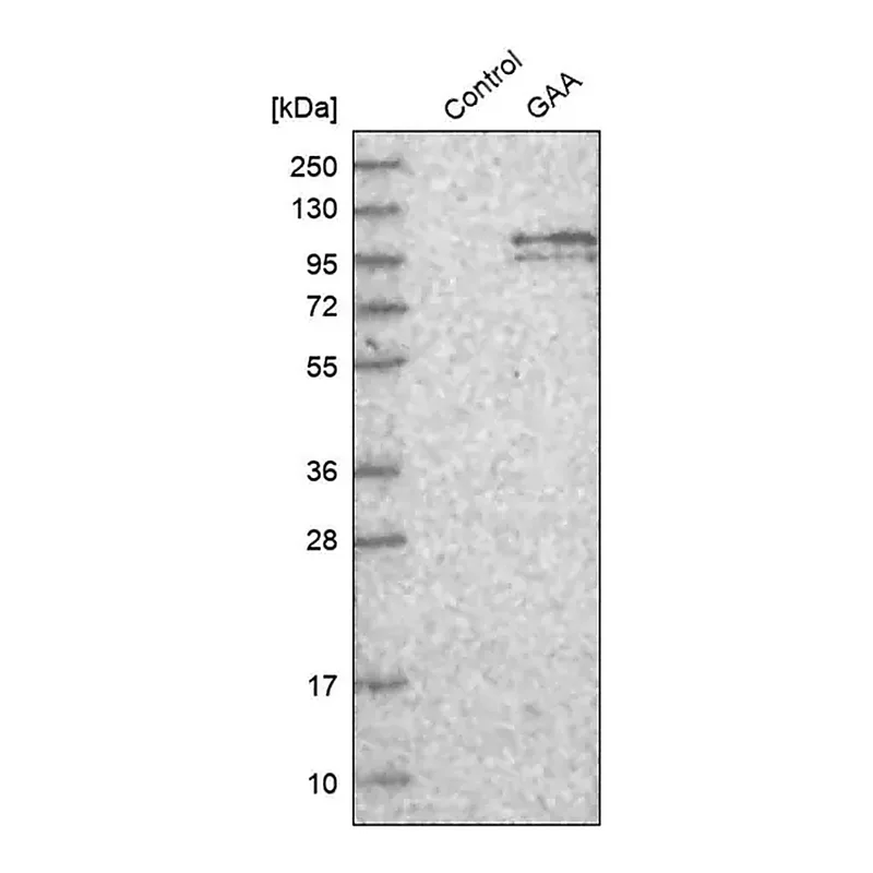 Merck Anti-GAA antibody produced in rabbit