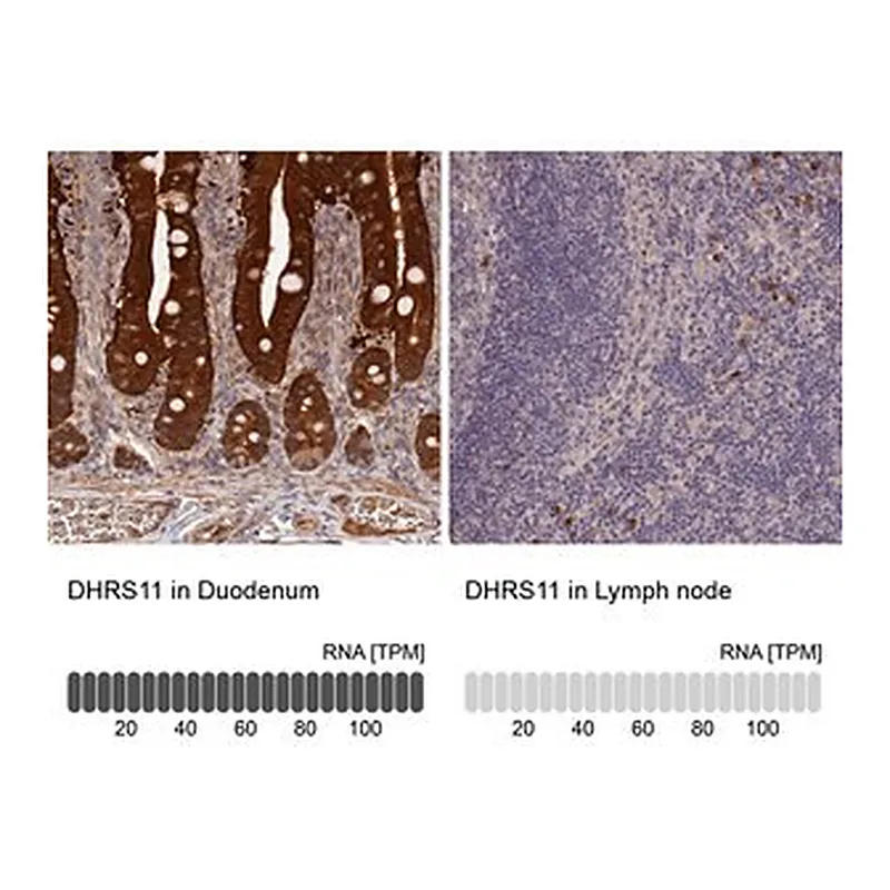 Merck Anti-DHRS11 antibody produced in rabbit