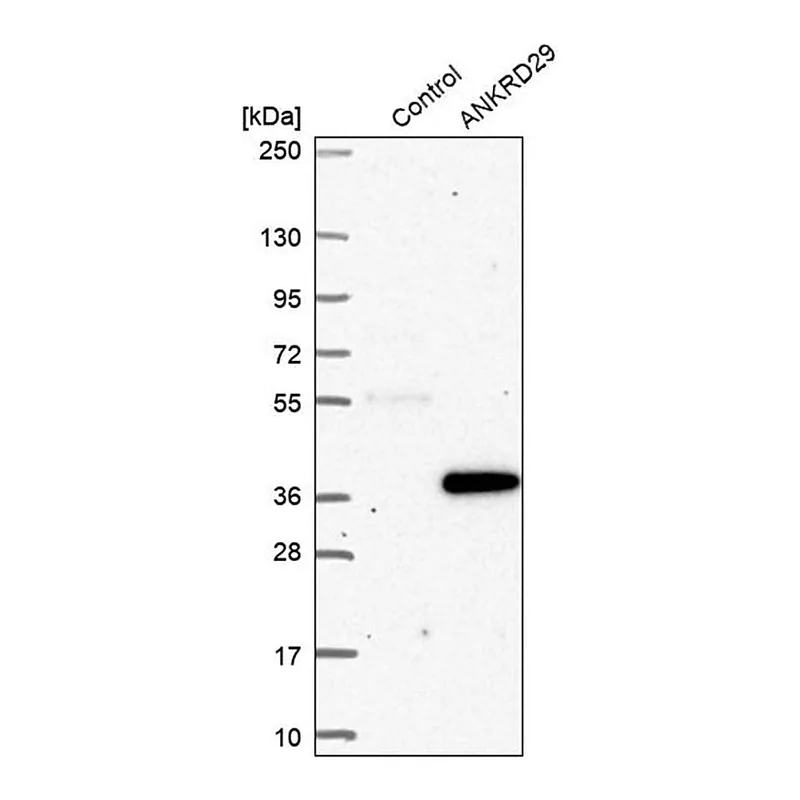 Merck Anti-ANKRD29 antibody produced in rabbit