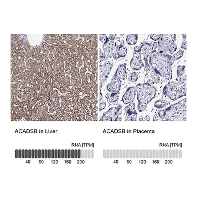 Merck Anti-ACADSB antibody produced in rabbit