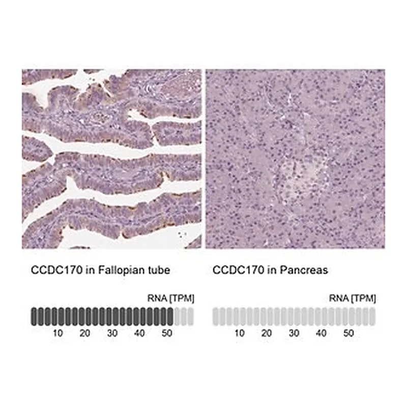 Merck Anti-CCDC170 antibody produced in rabbit