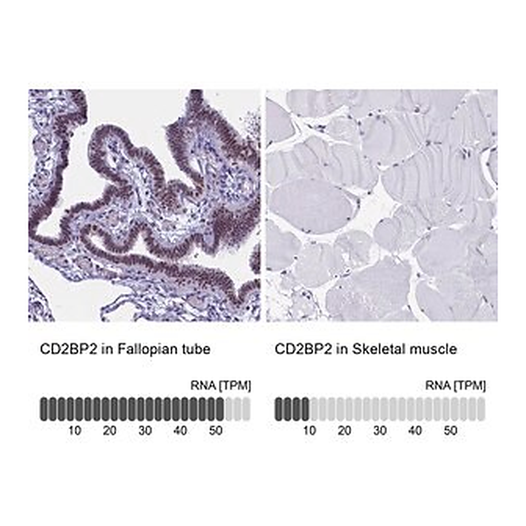 Merck Anti-CD2BP2 antibody produced in rabbit