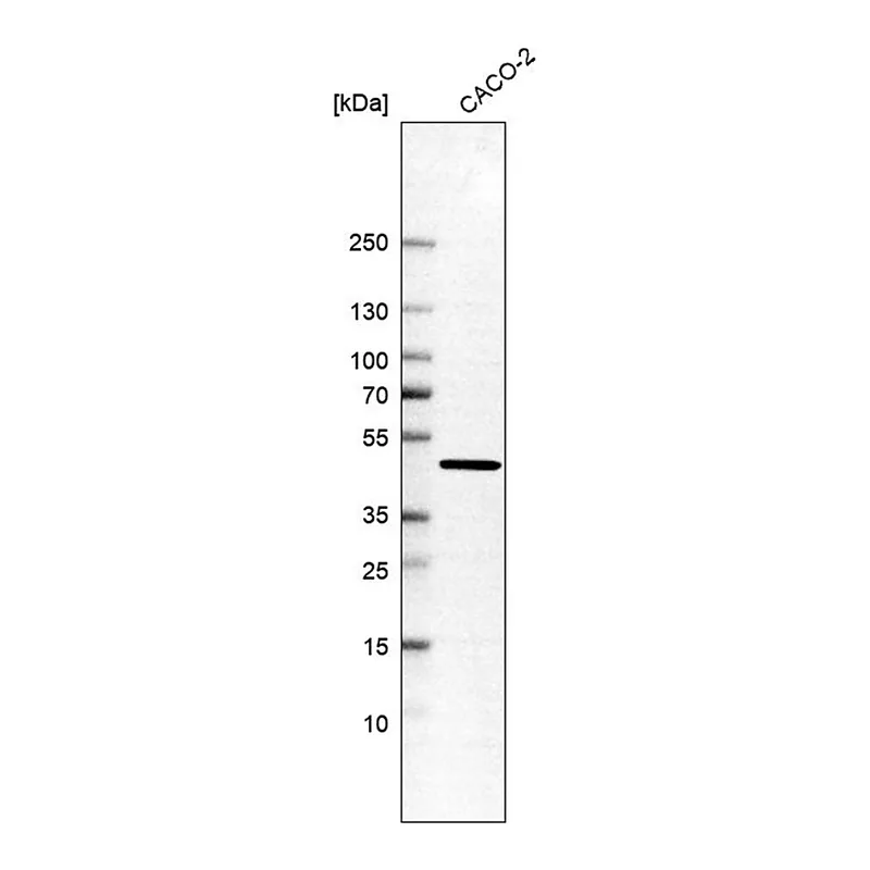 Merck Anti-AHCY antibody produced in rabbit