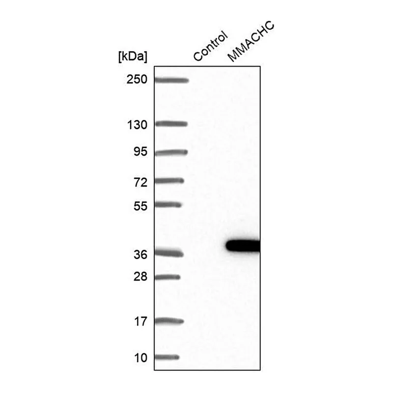 Merck Anti-MMACHC antibody produced in rabbit