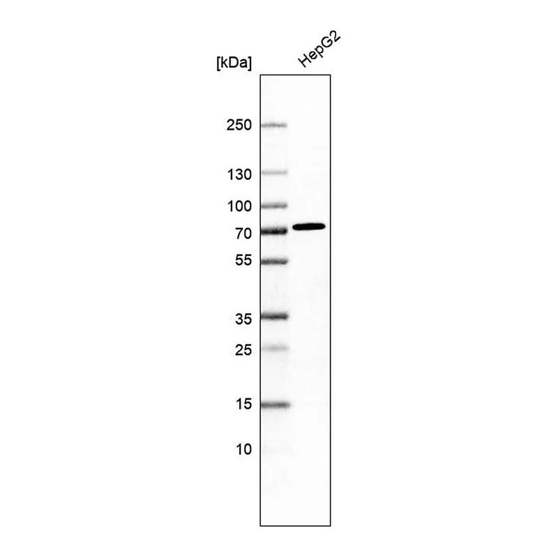 Merck Anti-ACSS3 antibody produced in rabbit
