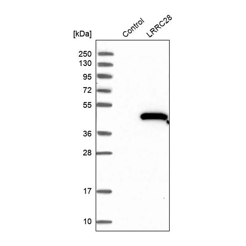 Merck Anti-LRRC28 antibody produced in rabbit