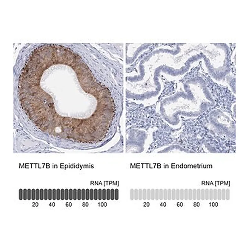Merck Anti-METTL7B antibody produced in rabbit
