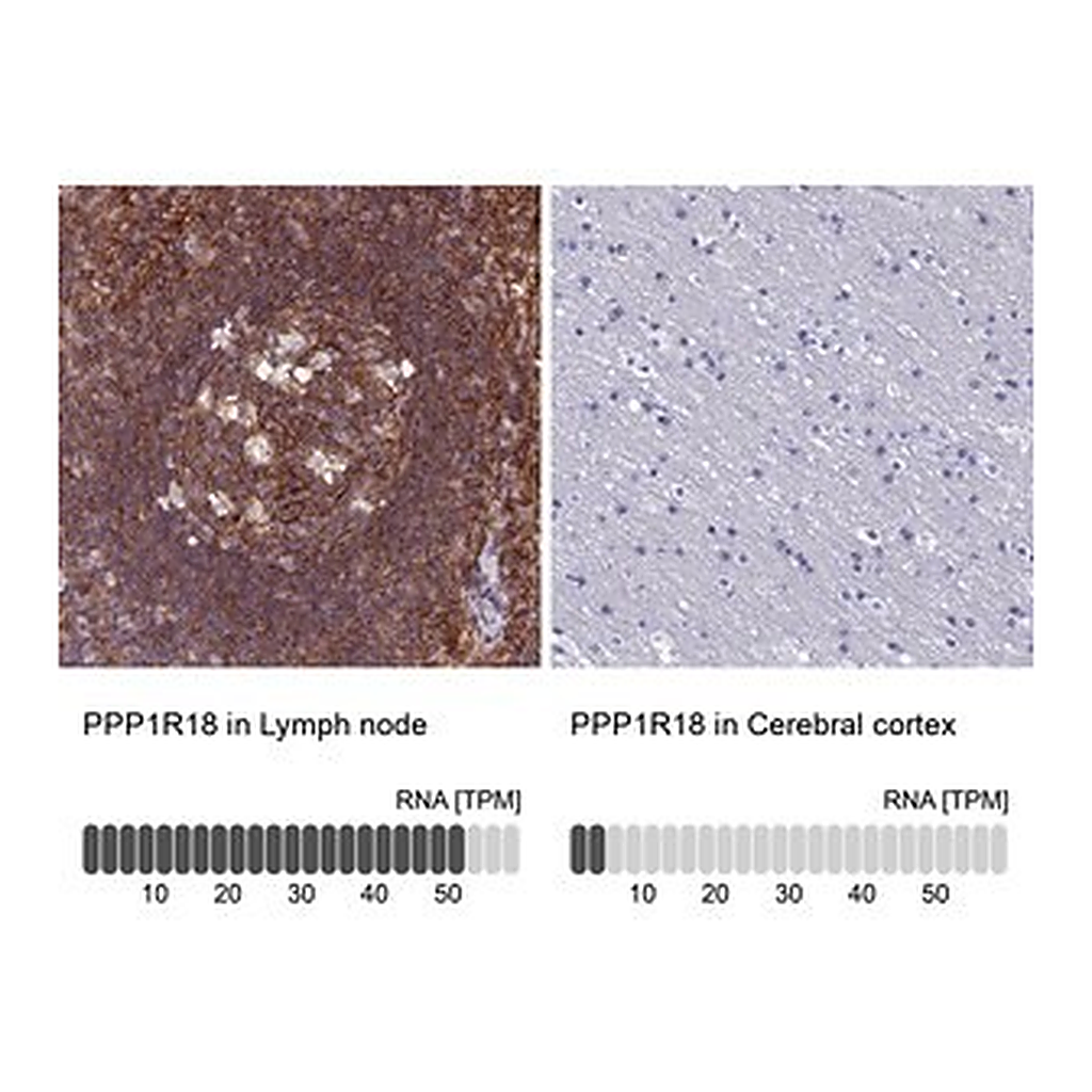 Merck Anti-PPP1R18 antibody produced in rabbit