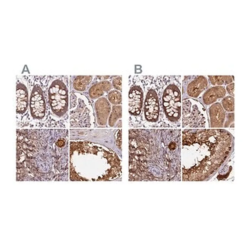 Merck Anti-ST13 antibody produced in rabbit
