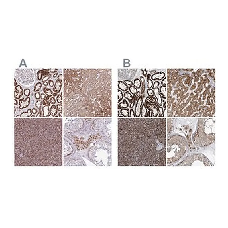 Merck Anti-SUCLG2 antibody produced in rabbit