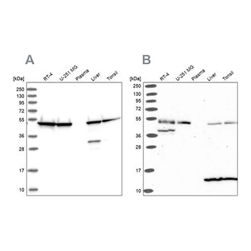 Merck Anti-ST13 antibody produced in rabbit
