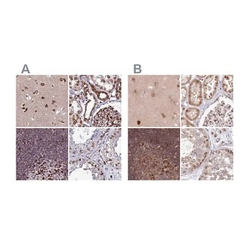 Merck Anti-TOR1AIP1 antibody produced in rabbit