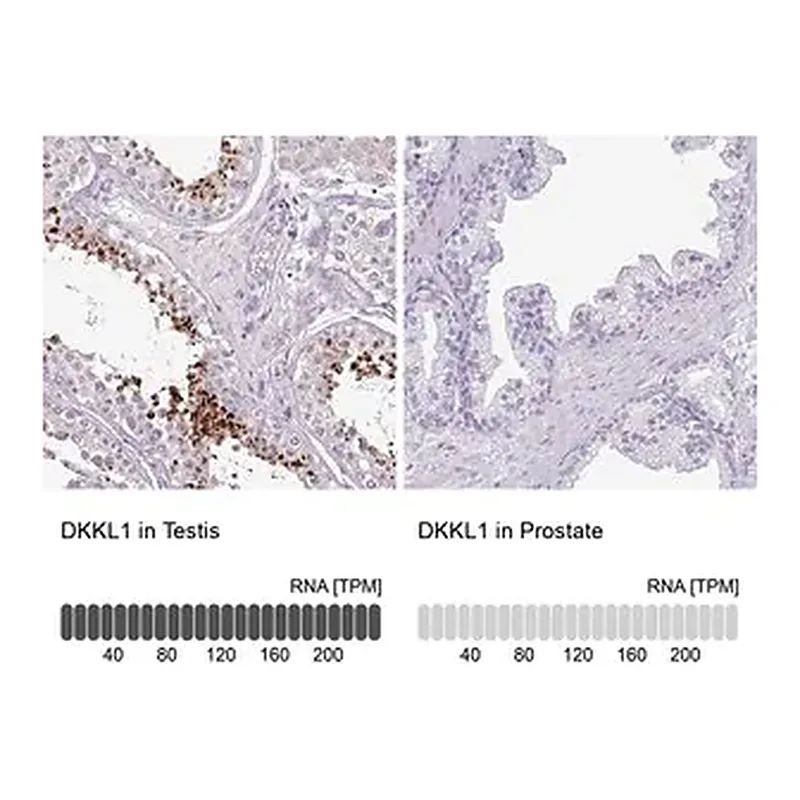 Merck Anti-DKKL1 antibody produced in rabbit
