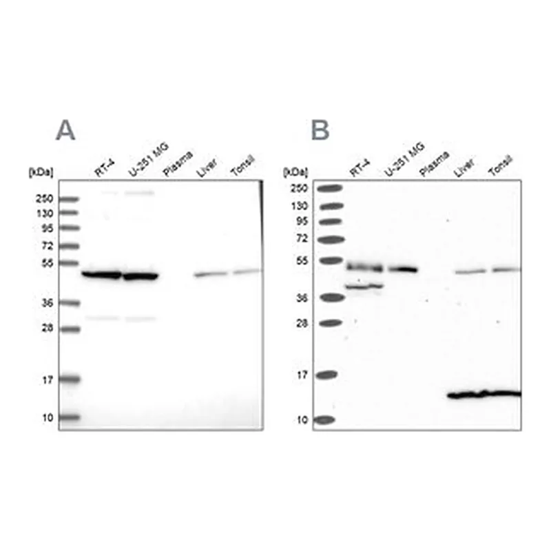 Merck Anti-ST13 antibody produced in rabbit