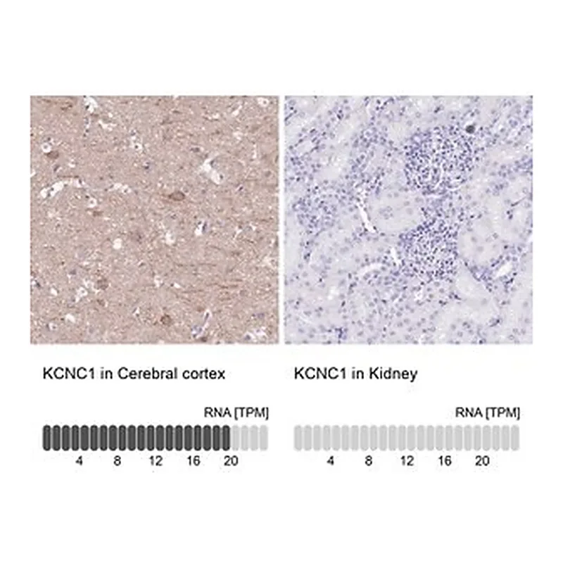Merck Anti-KCNC1 antibody produced in rabbit