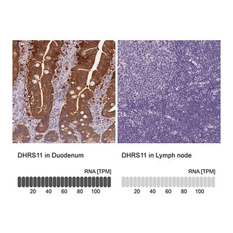 Merck Anti-DHRS11 antibody produced in rabbit