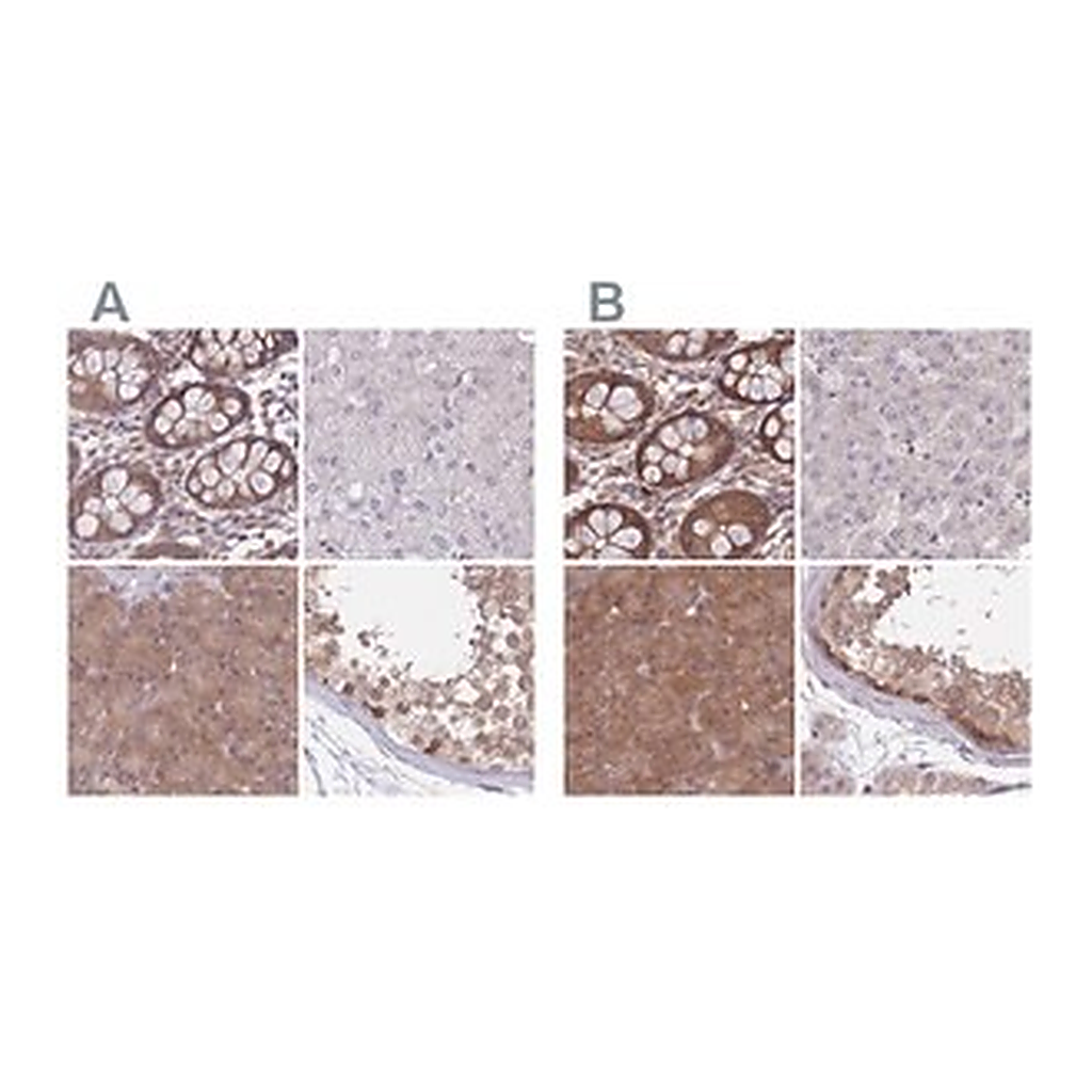 Merck Anti-PFDN6 antibody produced in rabbit