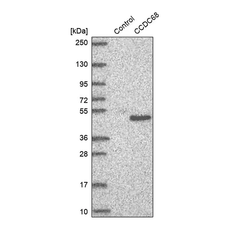 Merck Anti-CCDC68 antibody produced in rabbit