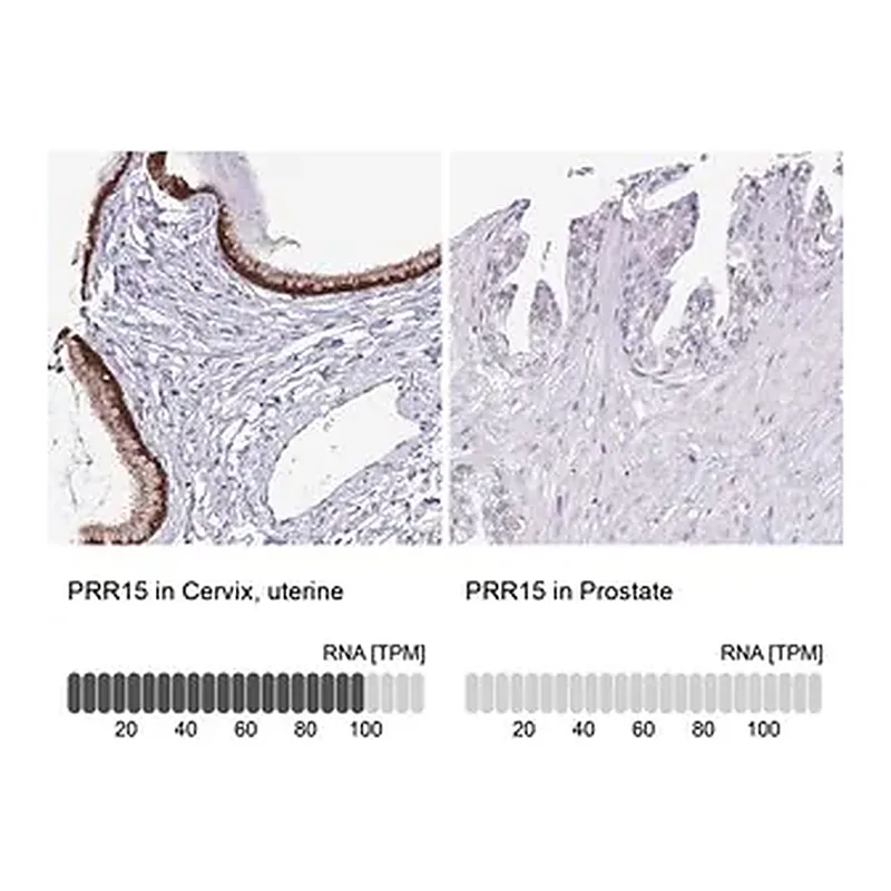 Merck Anti-PRR15 antibody produced in rabbit