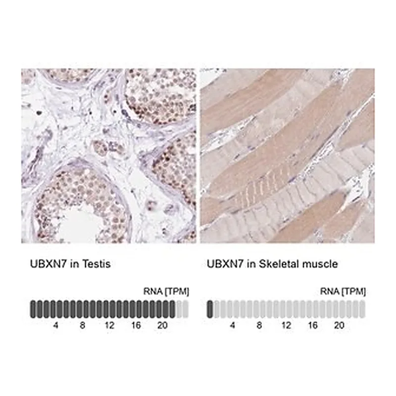 Merck Anti-UBXN7 antibody produced in rabbit