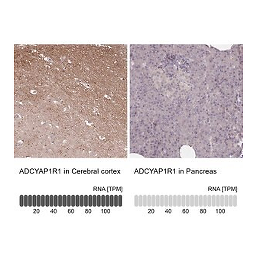 Merck Anti-ADCYAP1R1 antibody produced in rabbit