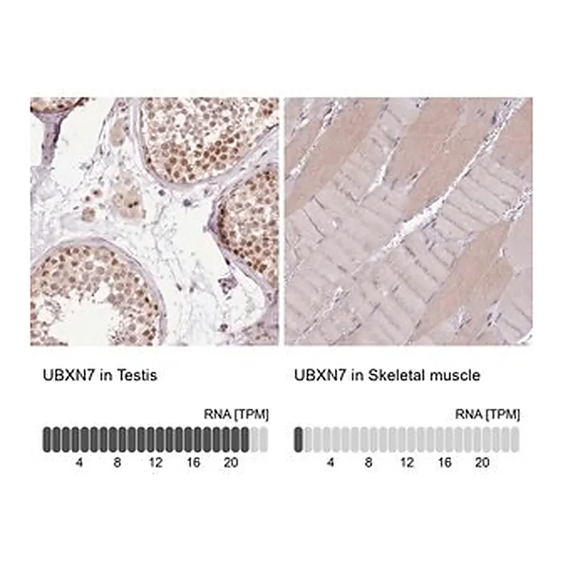 Merck Anti-UBXN7 antibody produced in rabbit