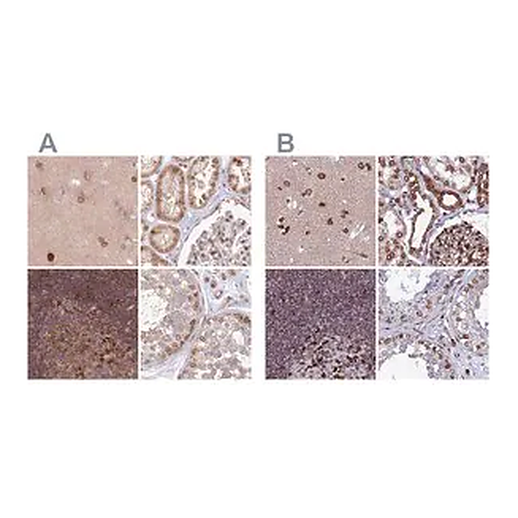 Merck Anti-TOR1AIP1 antibody produced in rabbit