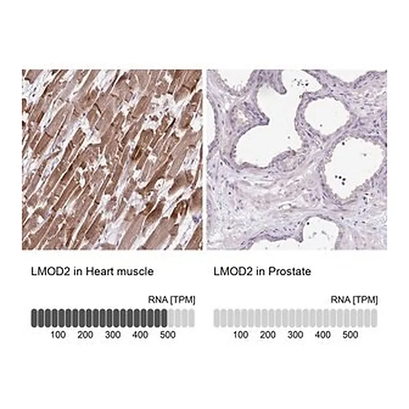 Merck Anti-LMOD2 antibody produced in rabbit