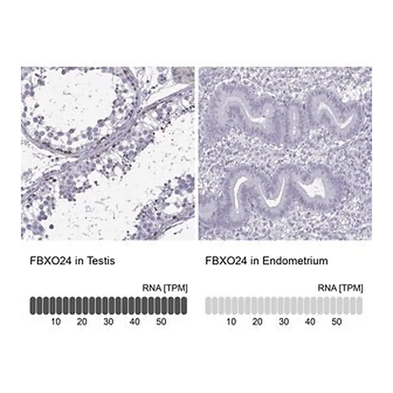 Merck Anti-FBXO24 antibody produced in rabbit