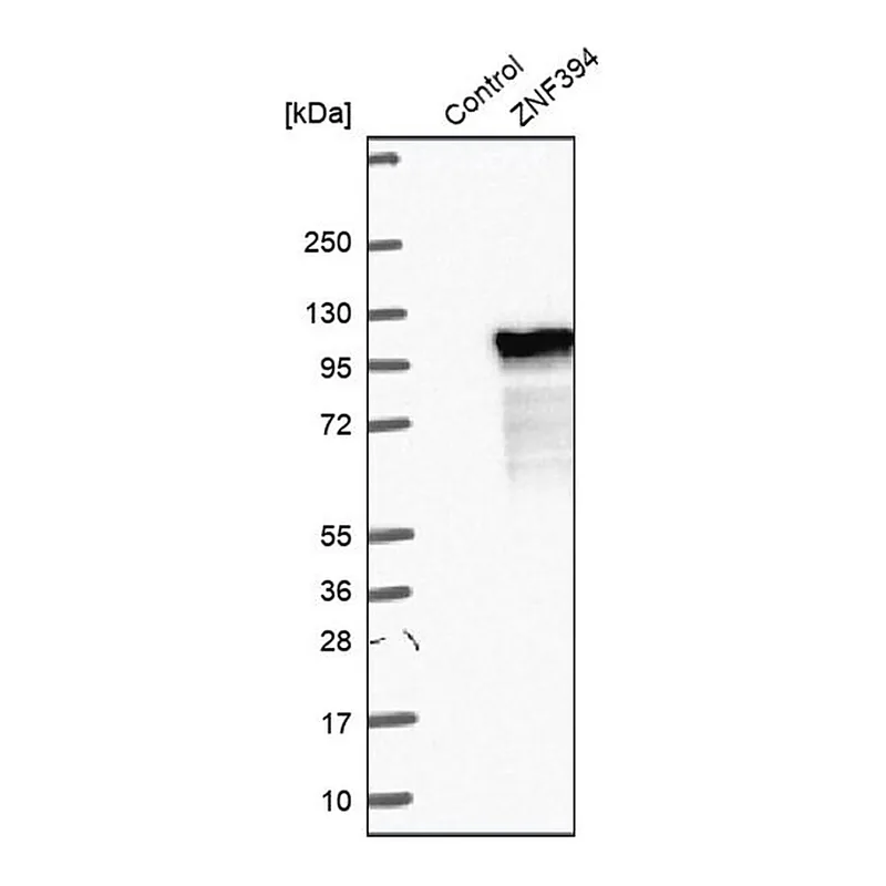 Merck Anti-ZNF394 antibody produced in rabbit