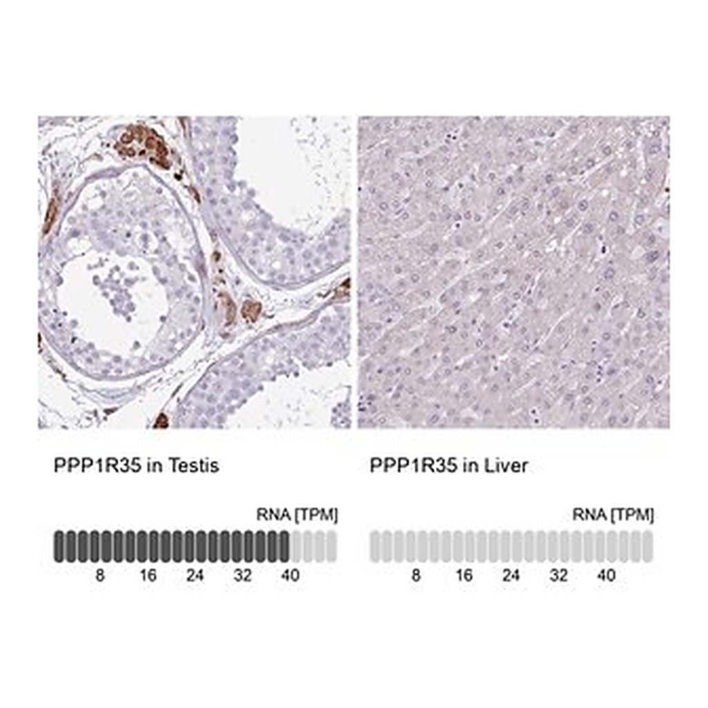 Merck Anti-PPP1R35 antibody produced in rabbit