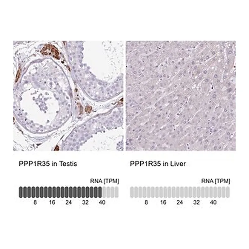 Merck Anti-PPP1R35 antibody produced in rabbit