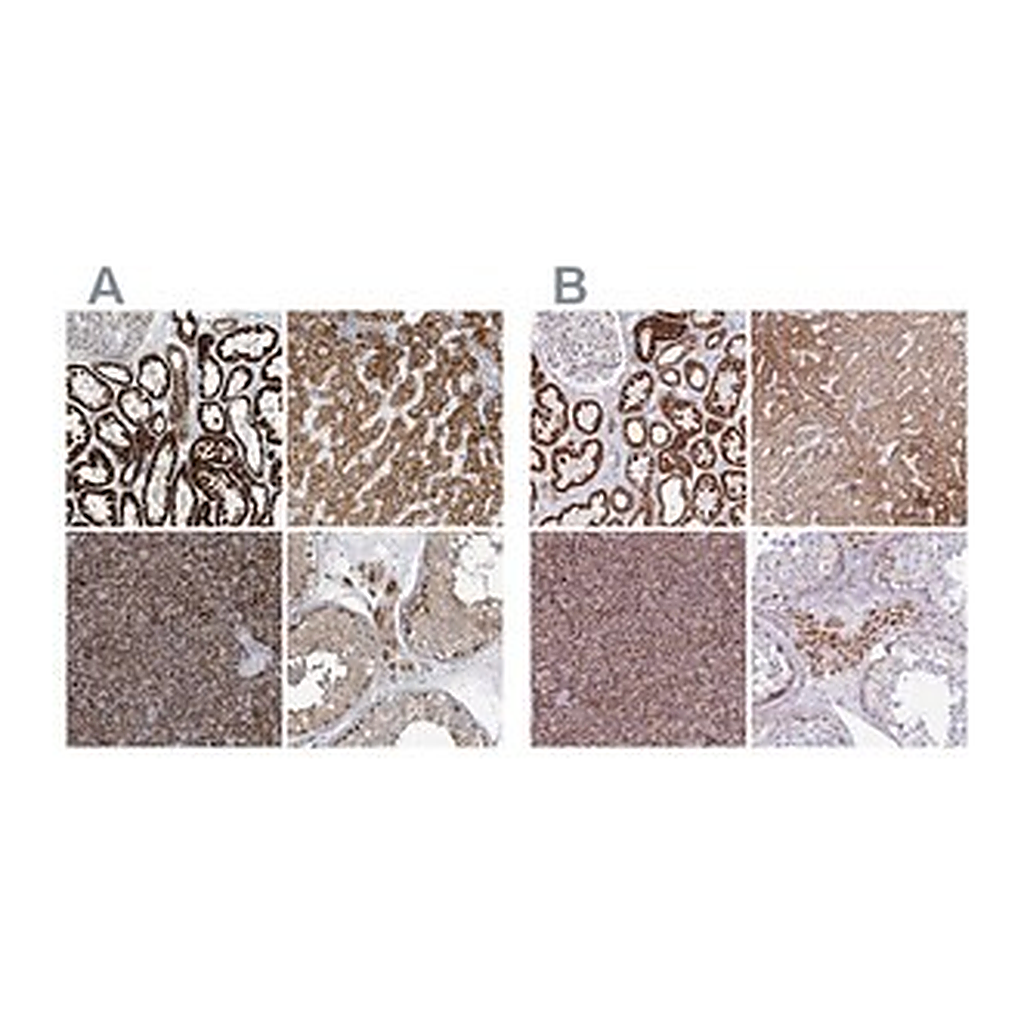 Merck Anti-SUCLG2 antibody produced in rabbit