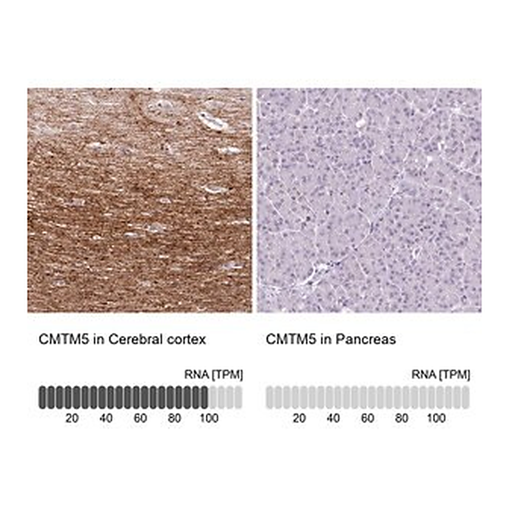 Merck Anti-CMTM5 antibody produced in rabbit