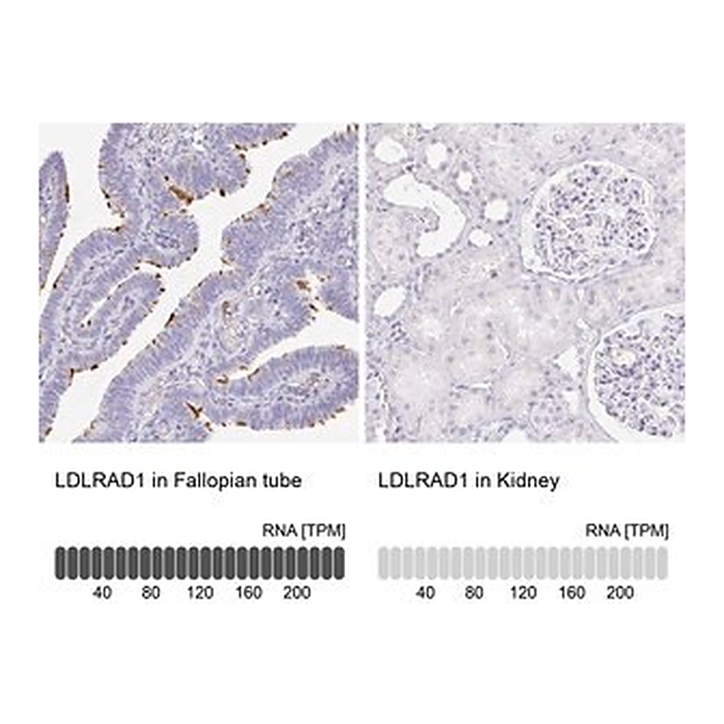 Merck Anti-LDLRAD1 antibody produced in rabbit