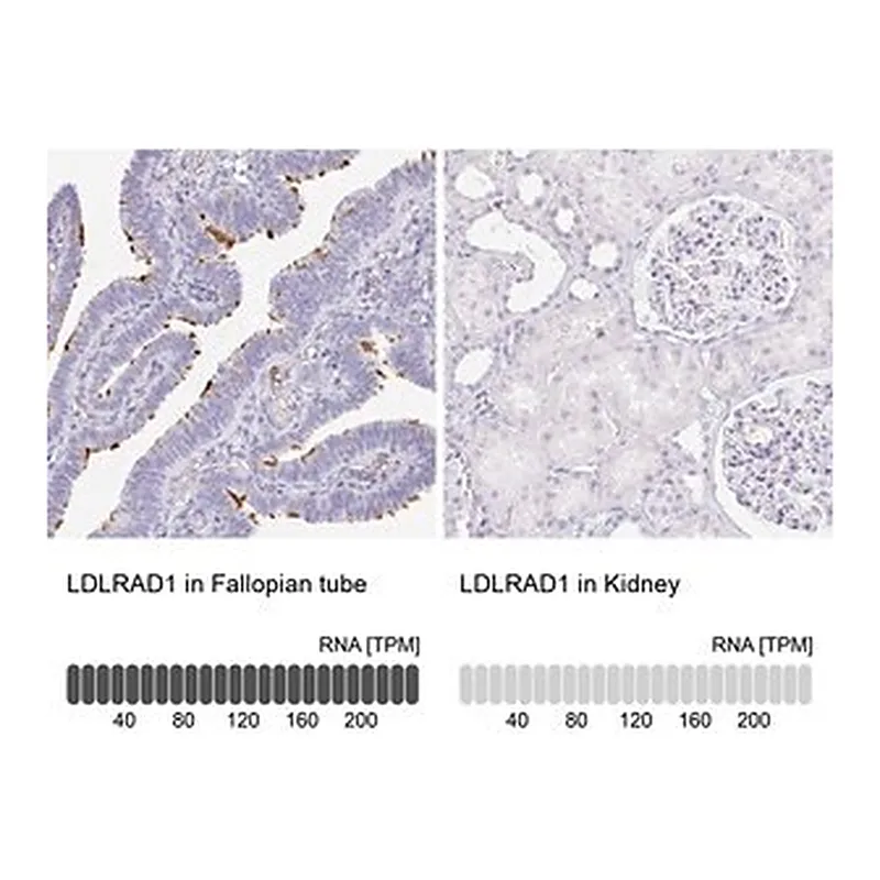 Merck Anti-LDLRAD1 antibody produced in rabbit