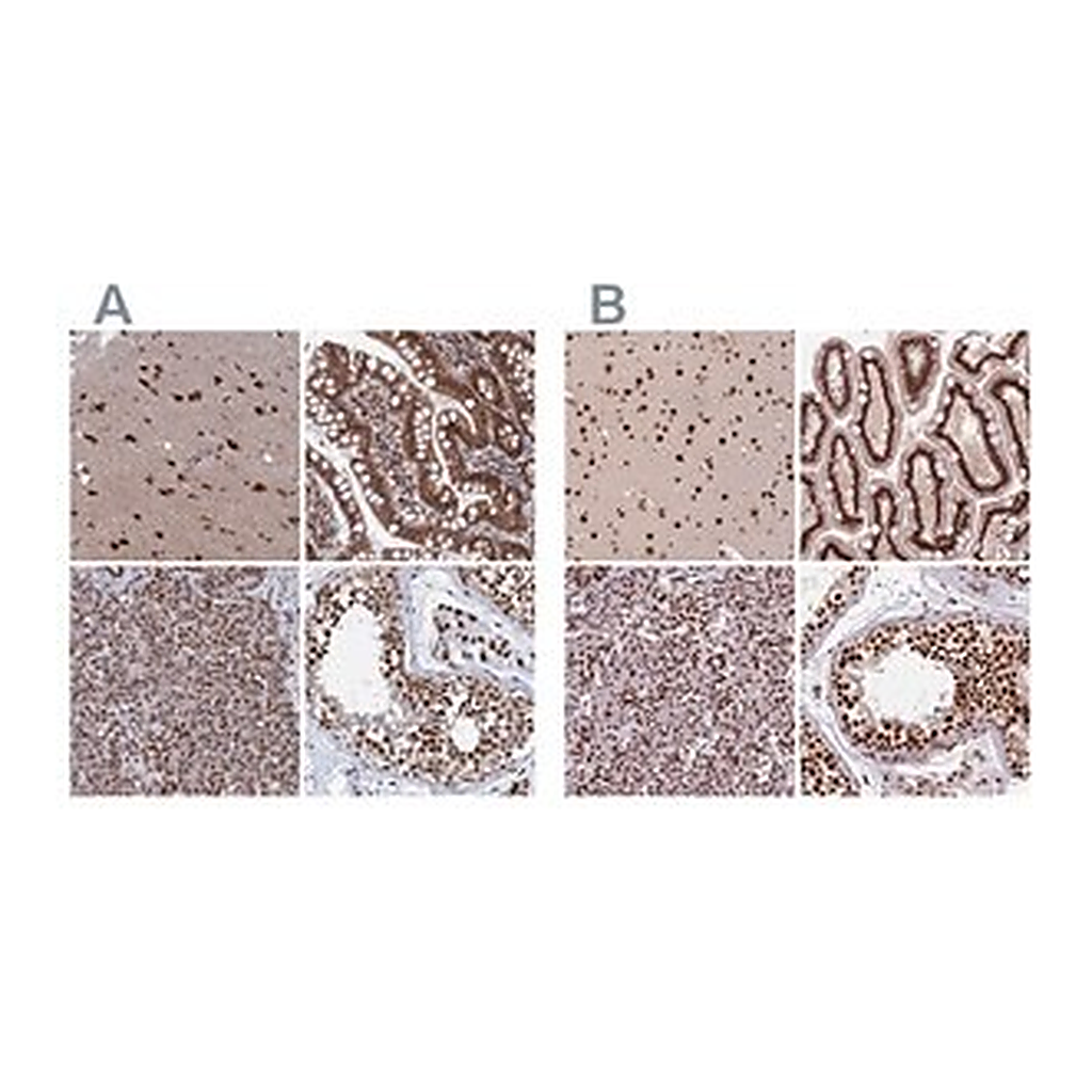 Merck Anti-CTB-50L17.10 antibody produced in rabbit