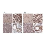 Merck Anti-CTB-50L17.10 antibody produced in rabbit