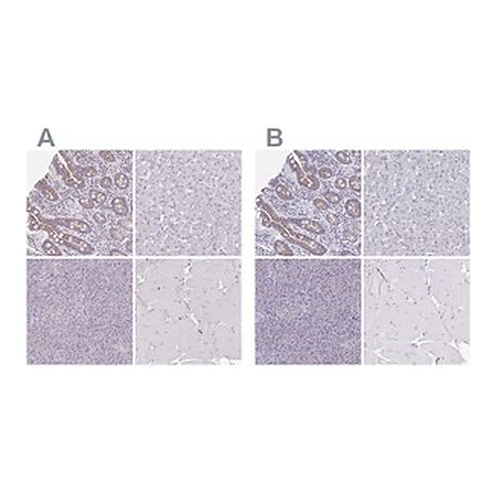 Merck Anti-CHMP5 antibody produced in rabbit