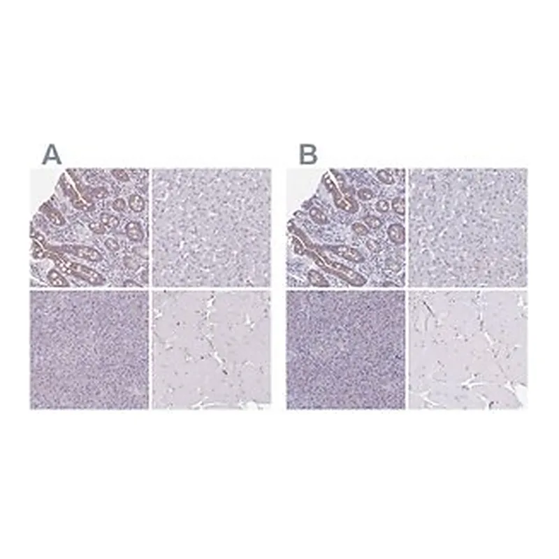Merck Anti-CHMP5 antibody produced in rabbit