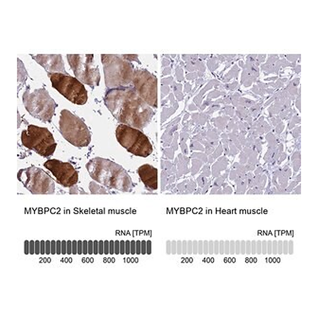 Merck Anti-MYBPC2 antibody produced in rabbit