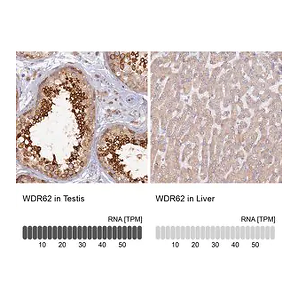 Merck Anti-WDR62 antibody produced in rabbit
