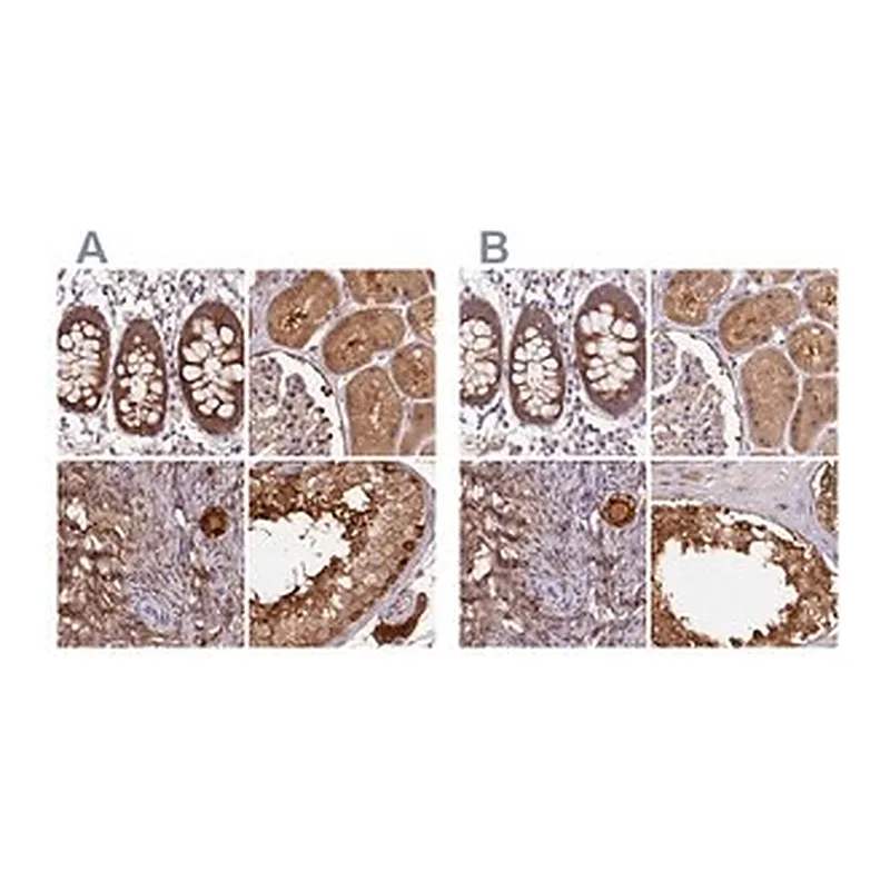 Merck Anti-ST13 antibody produced in rabbit