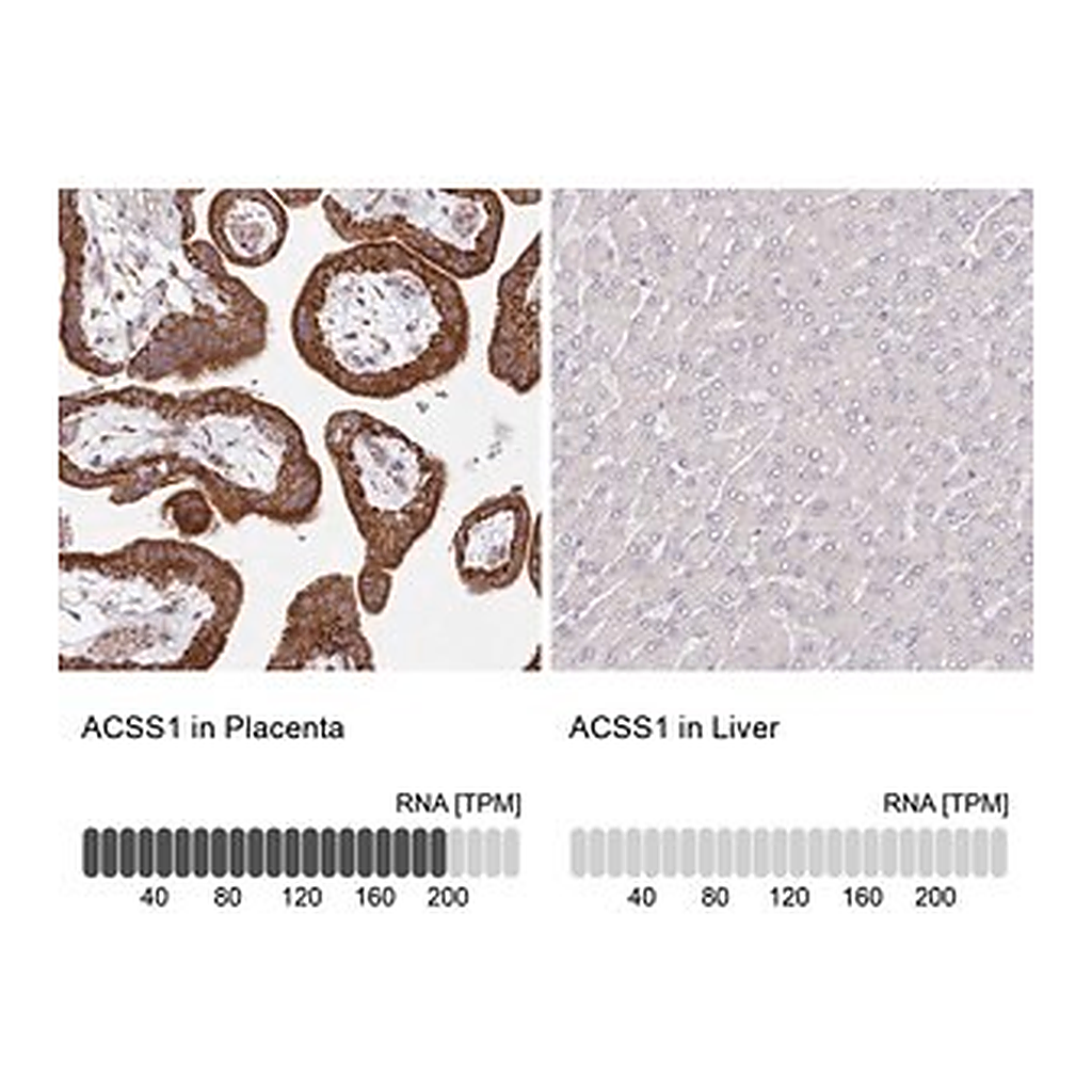 Merck Anti-ACSS1 antibody produced in rabbit